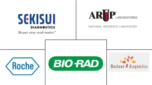 Global Homocysteine Testing Market Major Players